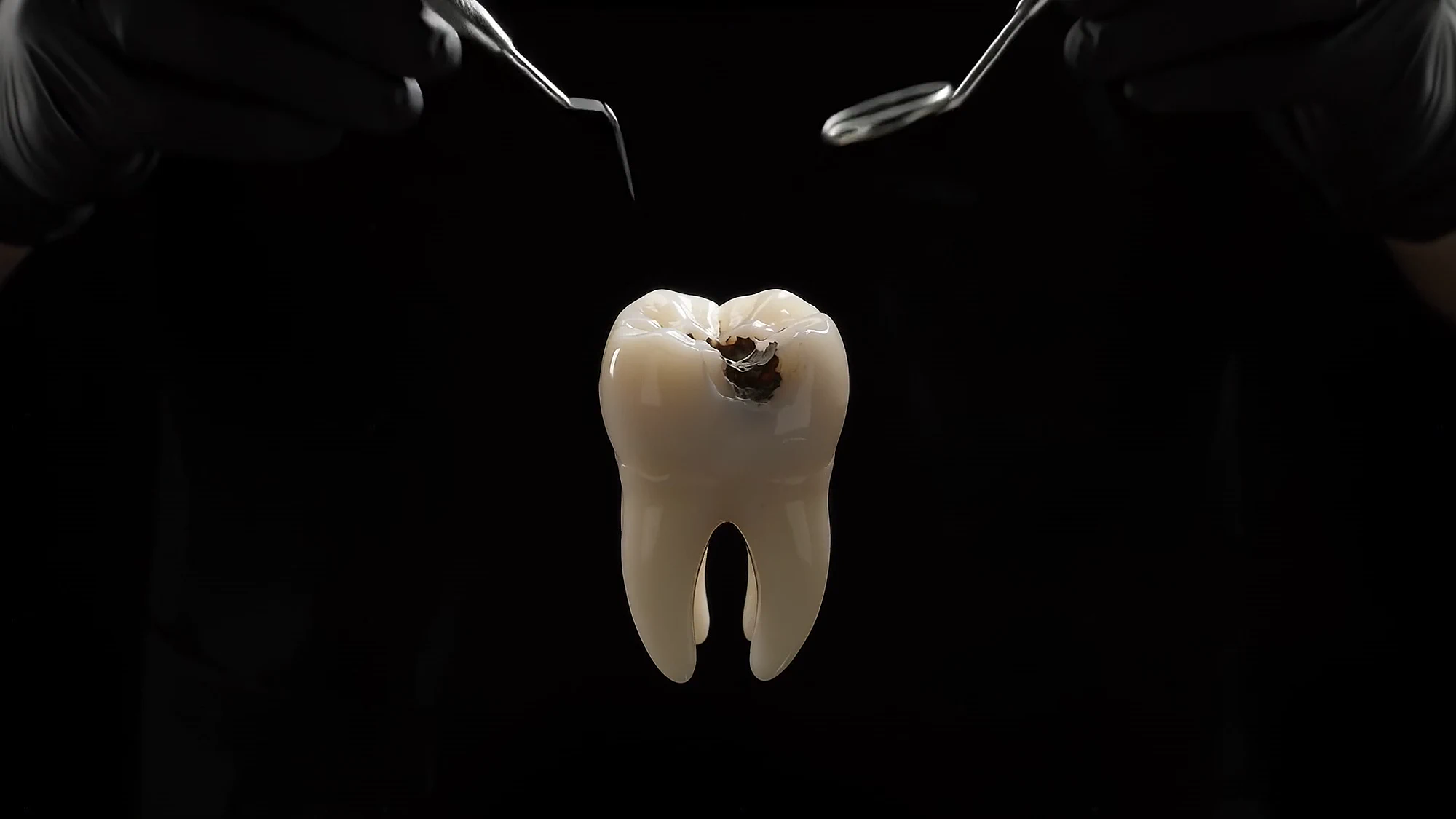 A tooth with a small cavity held between two dental instruments