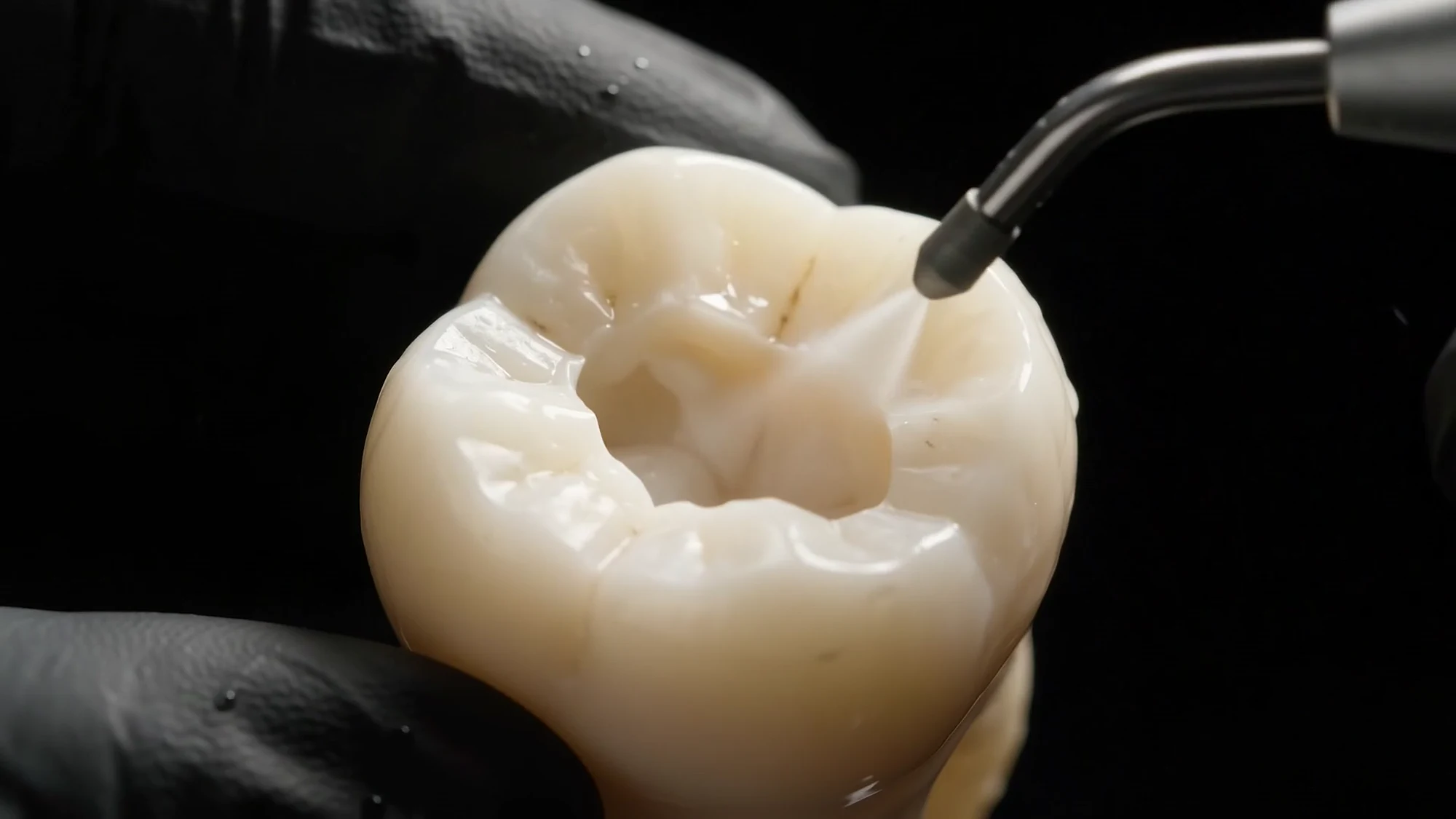 A clean cavity ready for restoration